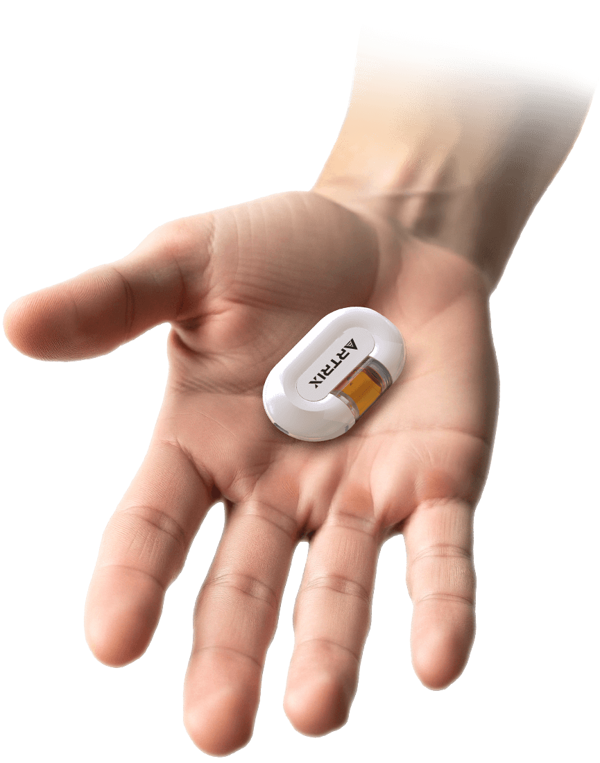 Ultra-Compact Rounded Glassic Device in Palm